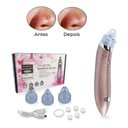 Ver imagem 5 de Máquina Sucção a Vácuo Remove Cravos Aparelho Acne Cleaning