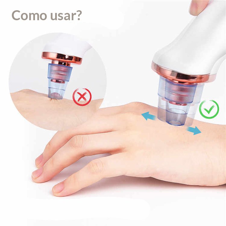 Máquina Sucção Remover Cravos Espinhas Acne Sugador a Vácuo - 5