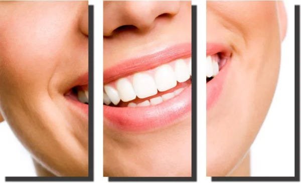 Quadro Decorativo Odontologia Dentista Varias Peças m3 - 3 Peças - 1