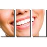 Quadro Decorativo Odontologia Dentista Varias Peças m3 - 3 Peças - 1