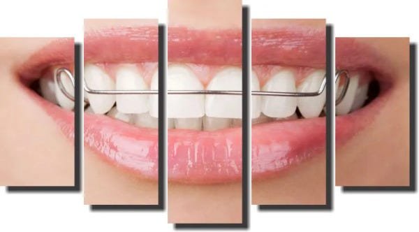 Quadro Decorativo Odontologia Dentista Varias Peças m1 - 5 peças - 1
