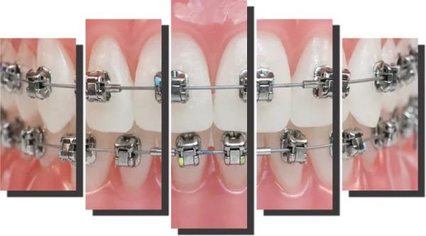 Quadro Decorativo Odontologia Dentista Varias Peças m2 - 5 peças - 1