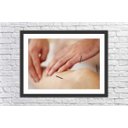 Ver imagem 1 de Quadro Decorativo Acupuntura Salas Decorações Interiores Com Moldura