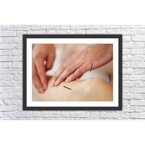 Quadro Decorativo Acupuntura Salas Decorações Interiores Com Moldura
