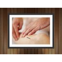 Ver imagem 3 de Quadro Decorativo Acupuntura Salas Decorações Interiores Com Moldura