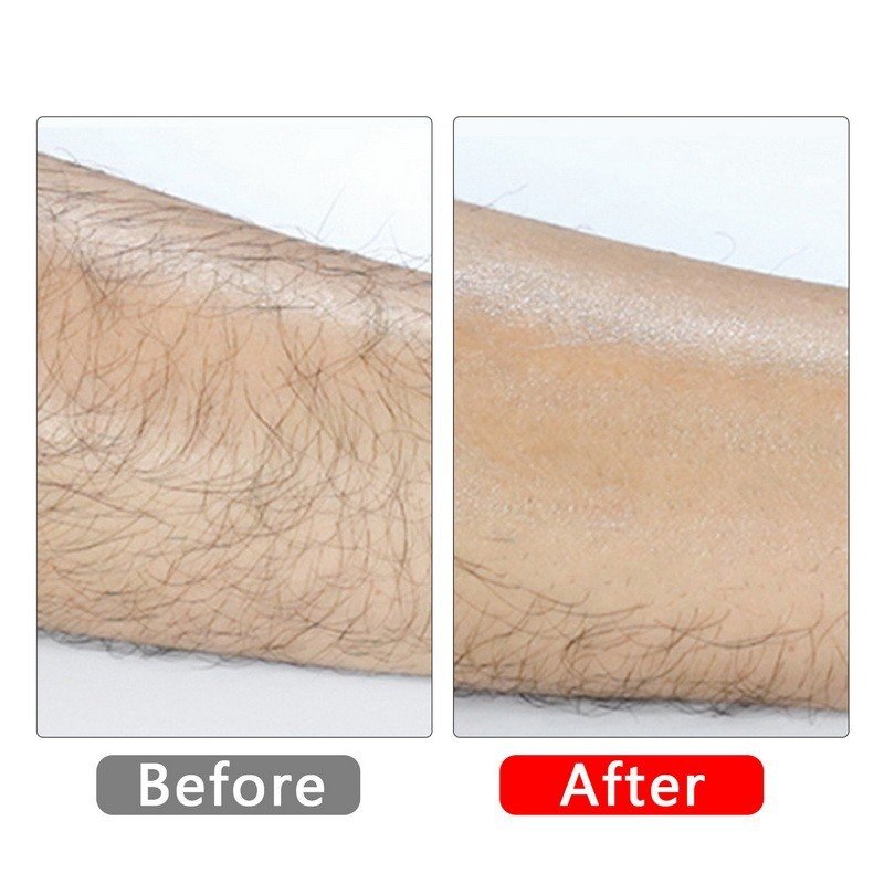 Depilador de Cristal Mágico Indolor sem Alergia - 3