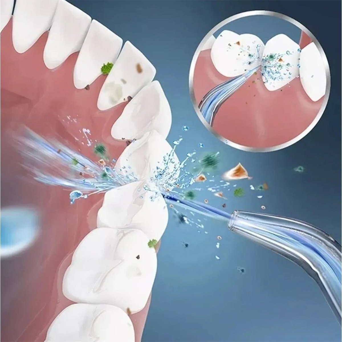 Irrigador Jato de Limpeza Dental Higiene Bucal Oral Eletrico Escova Dentes Lingua Gengiva Protese Ap - 11