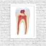 Quadro Decorativo Odontologia Anatomia Do Dente - 1
