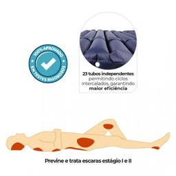 Colchão para Tratamento de Escaras Ii até 150 Kg Air Tube Dellamed - 3