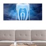 Quadro Dentista Dente Azul Decorativo 125X40 - 2