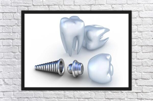 Quadro Profissão Dentista Odontologia Dentes Com Moldura G04 - 2