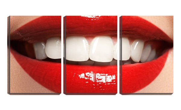 Quadro Decorativo 68x126 sorriso vermelho dentista - 2