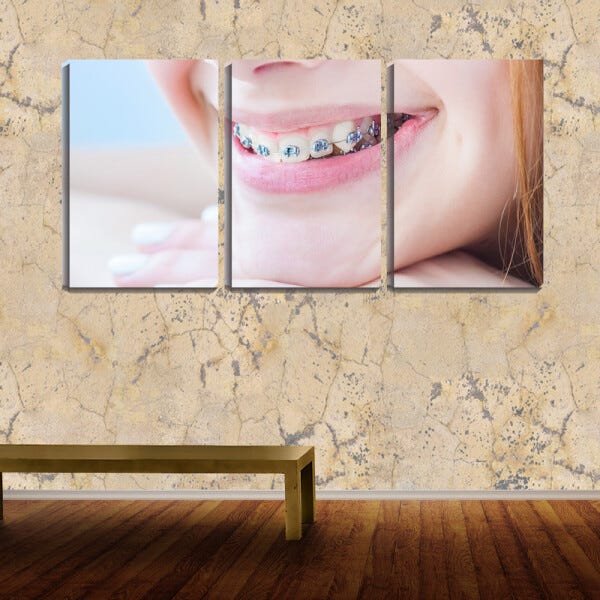 Quadro Decorativo 30x66 sorriso com aparelho odonto - 2