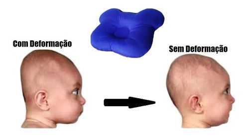 Travesseiro Plagiocefalia Cabeça Amassada Do Bebê - Azul escuro