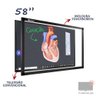 Moldura Touch Screen Interativa Unionboard 58 - 9