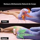 Ver imagem 4 de Travesseiro Para Pernas Ortopédico Lavável Profissional