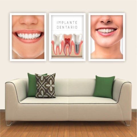 Conjunto Quadros Decorativos Com Moldura Branca - Consultório Dentista Orto E Implante - 50x70 - 1