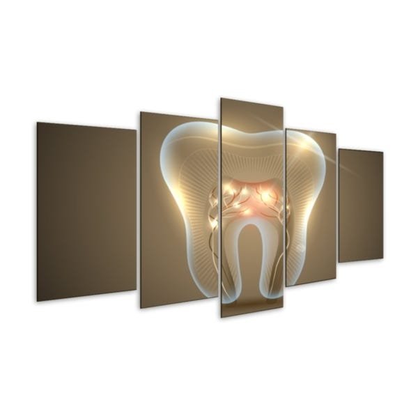 Quadro 5 Peças Dente Consultório Odontológico Mosaico Dentista Implante Canal - 2