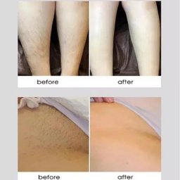 DEPILADOR LASER LCD DIGITAL DEPILACAO LUZ PULSADA PORTATIL MAQUINA REMOVEDOR DE PELOS DEPILADORA EM - 5