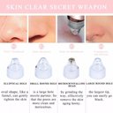 Ver imagem 4 de Máquina Sucção a Vácuo Remove Cravo Aparelho Acne Cleaning