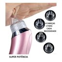 Ver imagem 2 de Aparelho Removedor Cravos Espinhas Acne Extrator Vácuo + Ítem Exclusivo - 4 Cb -usb