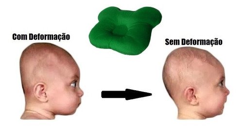 Travesseiro Plagiocefalia Cabeça Amassada Do Bebê - Verde