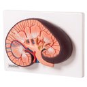 Ver imagem 2 de Rim Humano Básico em Corte Longitudinal, Anatomia