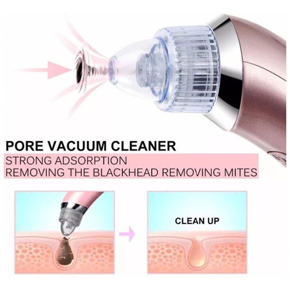 Máquina Sucção a Vácuo Remove Cravo Aparelho Acne Cleaning - 2