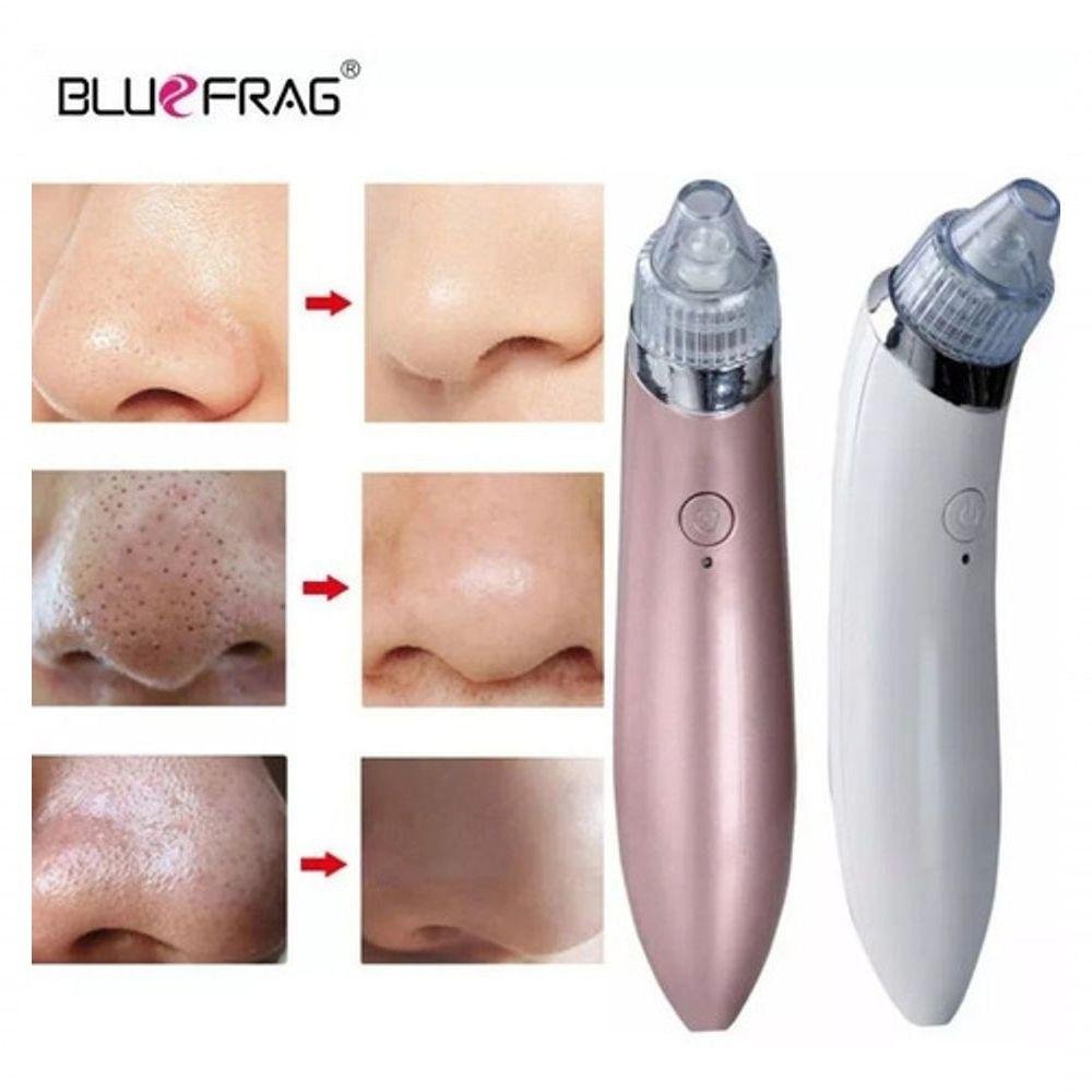 Máquina Sucção a Vácuo Remove Cravo Aparelho Acne Cleaning - 3