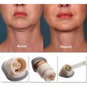 Ver imagem 5 de Aparelho Redutor de Papada Neckline Massageador Portátil
