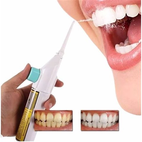 Kit 5 Unida Jato De Agua Bucal Limpeza Gengiva Dente Dental AB MIDIA 88830