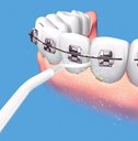 Ver imagem 7 de Kit 5 Unida Jato De Agua Bucal Limpeza Gengiva Dente Dental AB MIDIA 88830