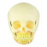 Crânio Infantil com Mandíbula Aberta em 2 Partes - 1