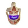 Protetor Bucal Superior Profissional Spank - Roxo - 2