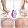 Pedra Depiladora Magica Depilador Tira Pelos Corpo Rosto Axila Braço Pernas Esfoliante Reutilizavel - 8