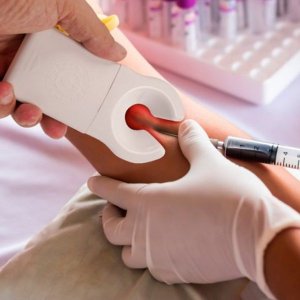 Venoscopio Localizador ACHA Veia Fleboscopio Profissional ORTHO Pauher