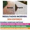 Limpa Pisos Pedra Tira Ferrugem Todo Tipo de Piso Casamop Galão 5l Casamop Kit 2 Unid - 5