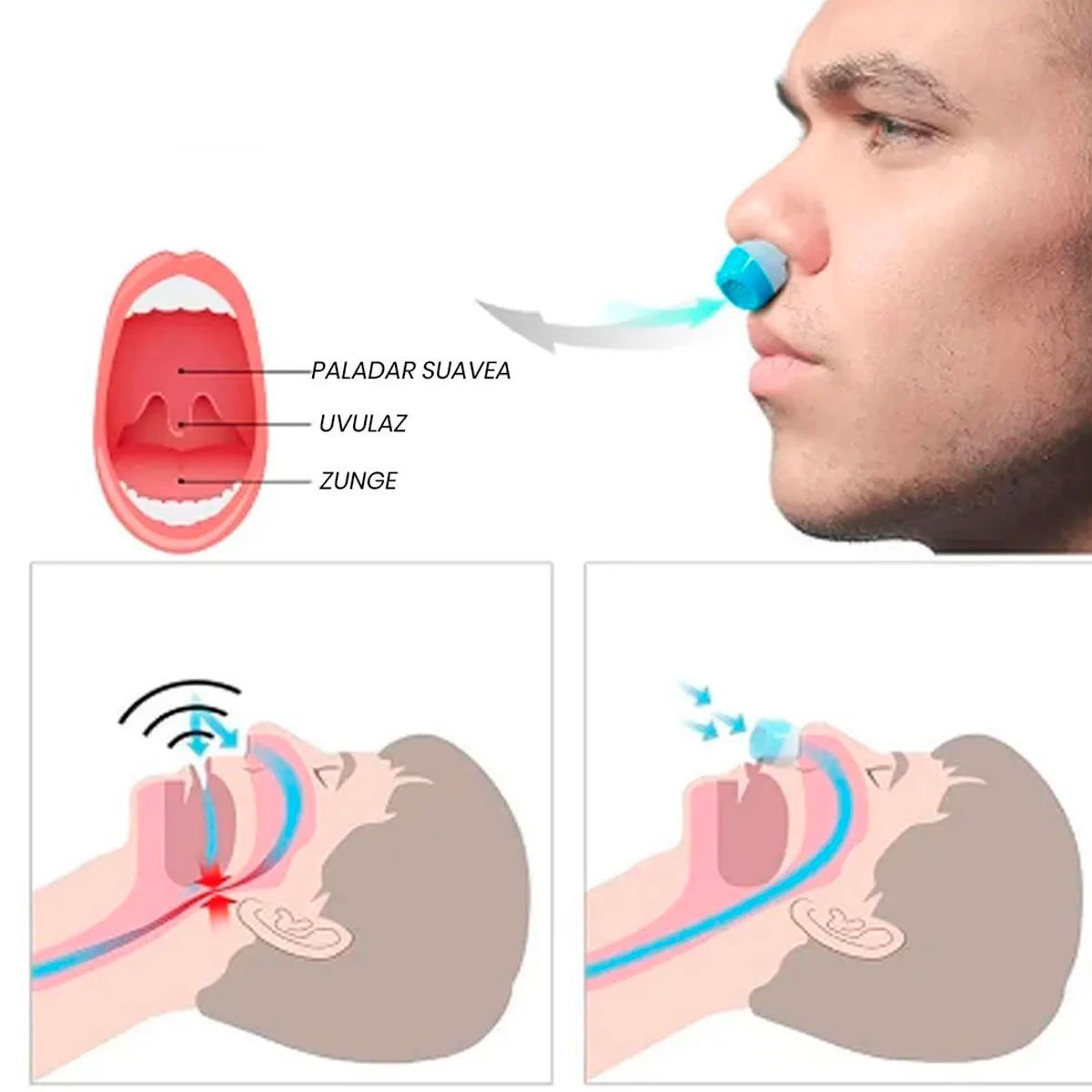 Aparelho Anti Ronco Apneia Dilatador Nasal - 3