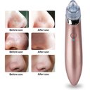 Ver imagem 4 de Removedor de Cravos e Espinhas Aparelho Limpeza Facial Poros Rosto Beleza Saúde