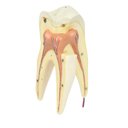 Ver imagem 3 de Dente Molar Superior C/ Raiz Tripla em 3 Partes, 8x