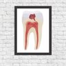 Quadro Decorativo Odontologia Anatomia Do Dente - 1