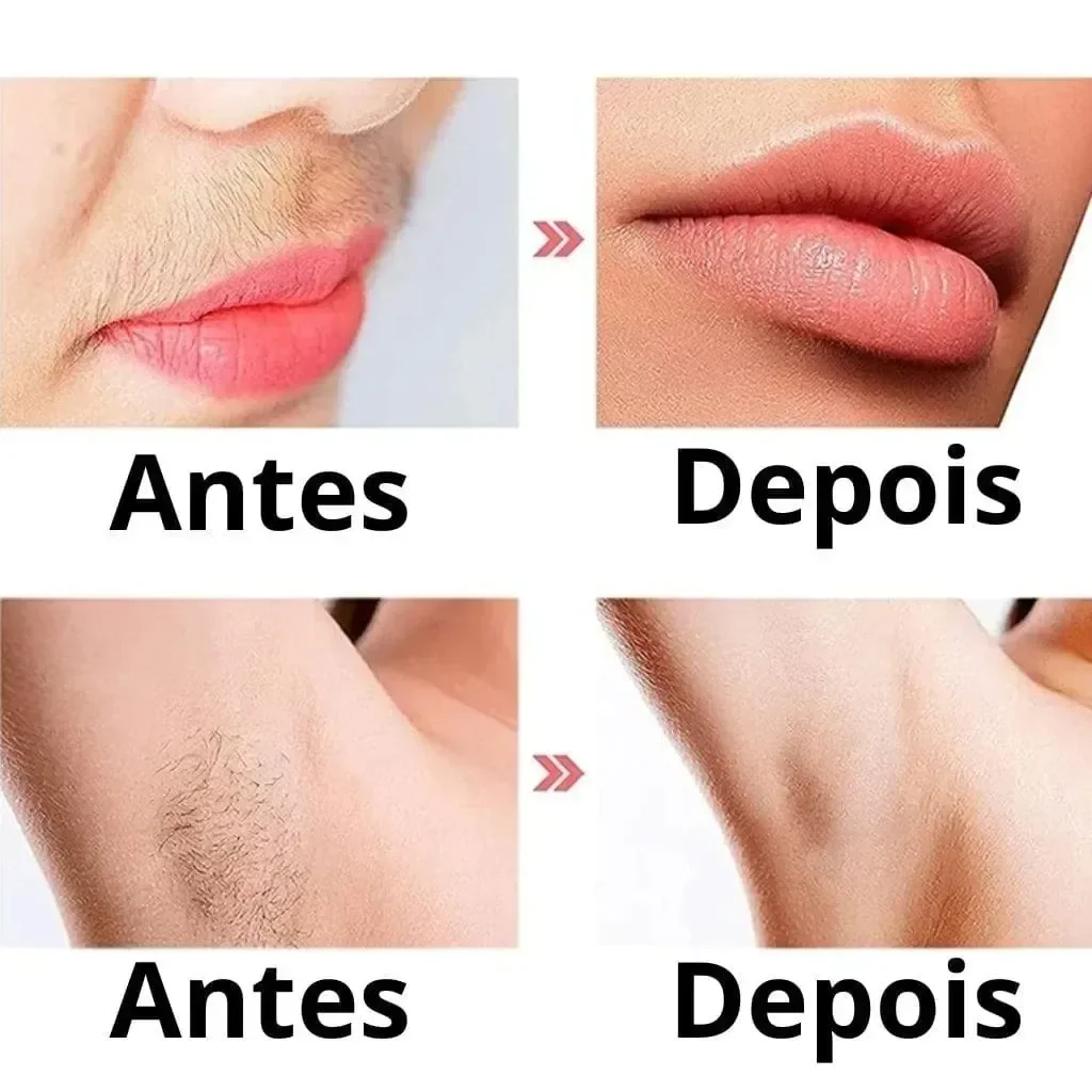 Ver imagem 6 de Caneta Depiladora Facial Elétrica Removedor de Pelos sem Dor