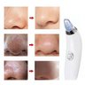 Aparelho Removedor de Cravos Limpeza Facial Acne Espinhas Poros Sucçao Vacuo Beleza - 5