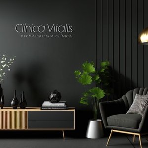 Perfil de Alumínio para Acabamento 3,10mm X 0,935cm Laminum