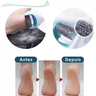 Kit 3 Esfoliador Removedor Calos Lixa Pé Portátil Pedicure - 10