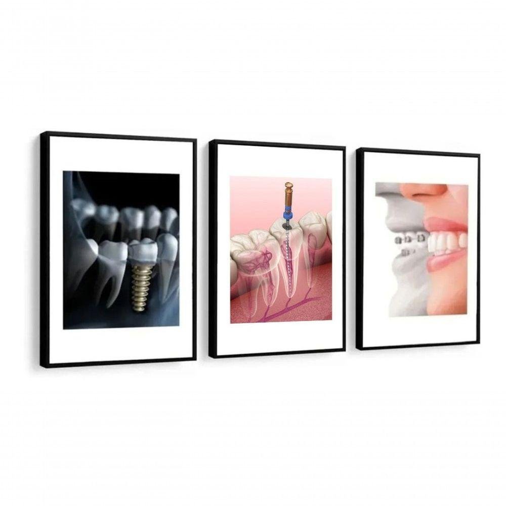 Kit 3 Quadros Decorativos Odontologia Consultório Dentistas - 1